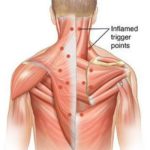 мышцы спины