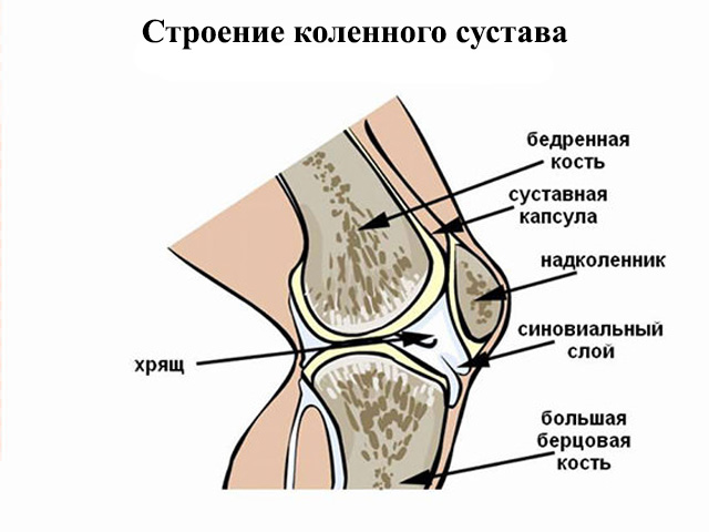 Схематический рисунок 