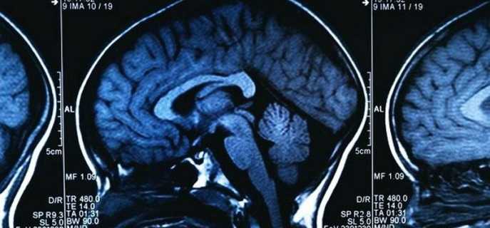Способы лечения опухоли головного мозга