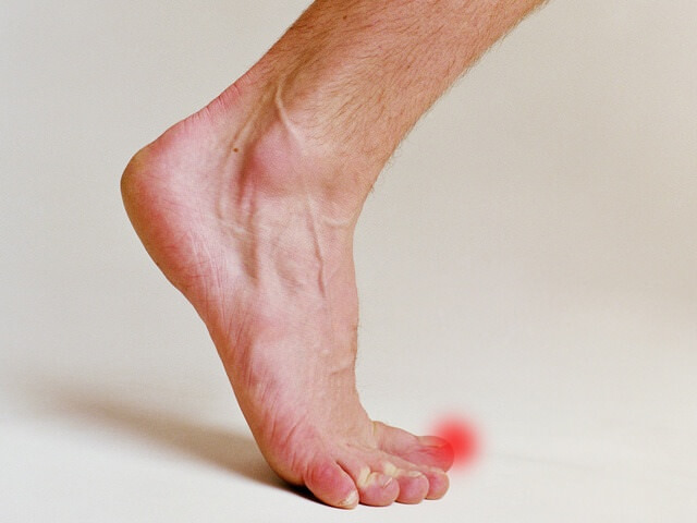 Дискомфорт в пальцах ног