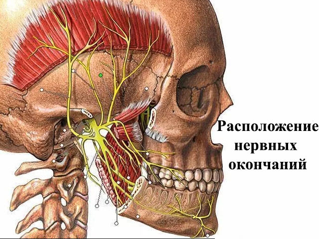 Схема черепа 
