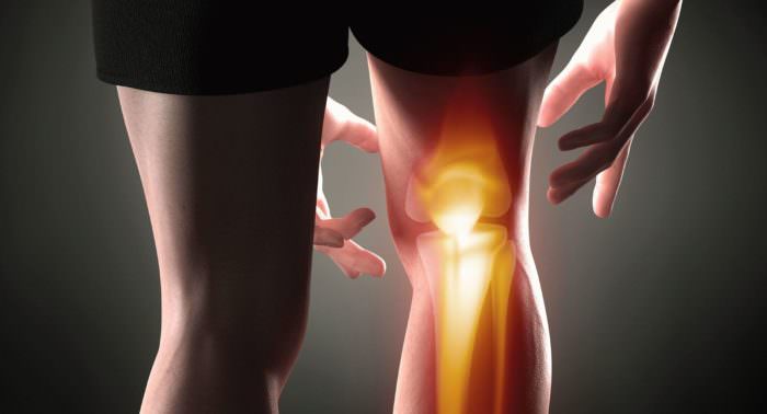 Первые симптомы проявления коленного артроза