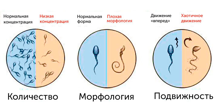 Количество, морфология и подвижность сперматозоидов