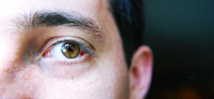 Виды, причины и лечение кровоизлияния в глаз