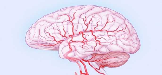 Заболевания сосудов головного мозга и их диагностика