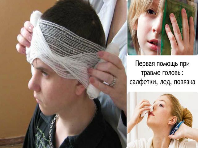 Комплекс экстренных медицинских мероприятий при травме головы 
