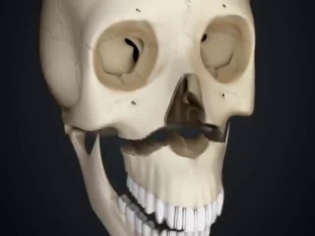 Перелом верхней и нижней отделов челюсти