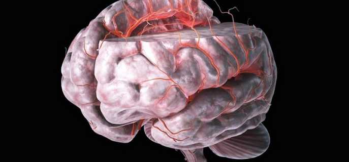Признаки и лечение инсульта в бассейне средней мозговой артерии