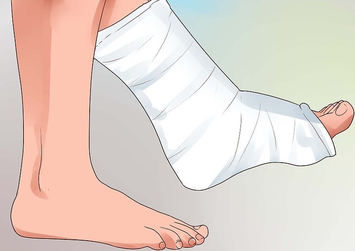 Что делать при переломе пальца на ноге
