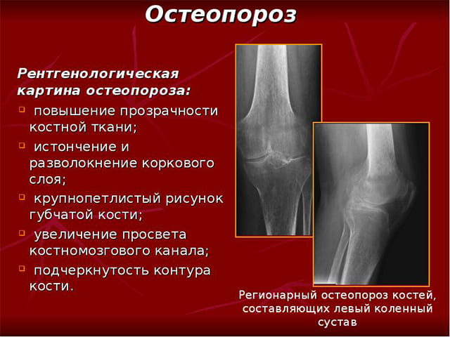 Основные причины боли в коленном суставе