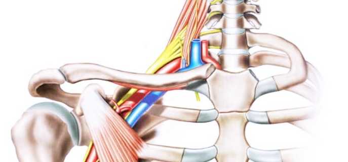 Причины неврита плечевого нерва, симптомы заболевания и его лечение