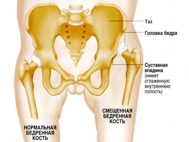 Анатомическое строение таза