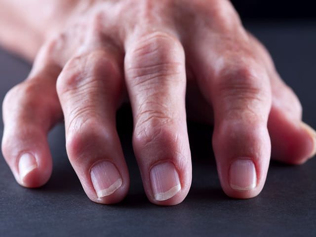 как лечить заболевание пальцев рук