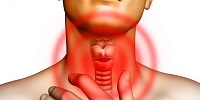 Болезнь щитовидки