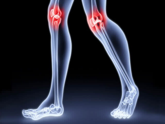 Больные коленные суставы
