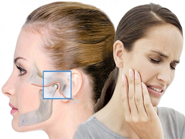 Как лечить артрит челюстно-лицевого сустава