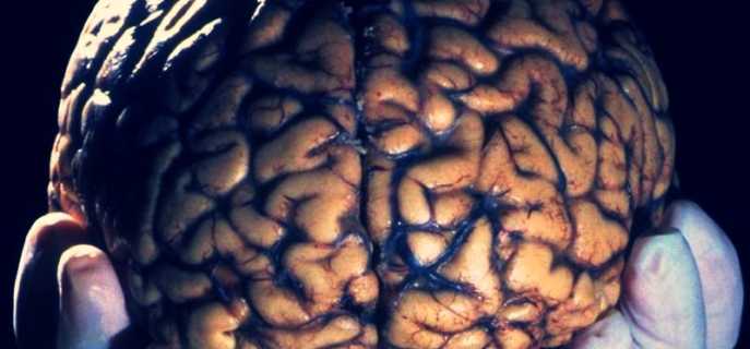 Сколько живёт человеческий мозг после смерти
