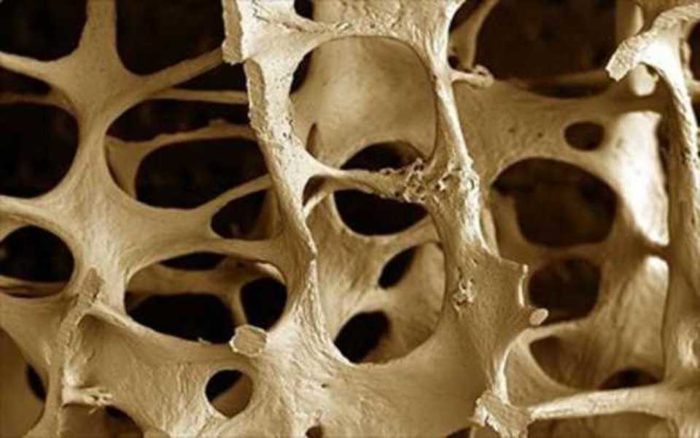 структура кости с раком