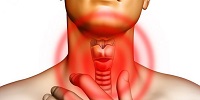 Симптомы аутоиммунного тероидита щитовидной железы и способы лечения в домашних условиях
