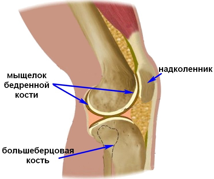 Переломы мыщелков коленного сустава 