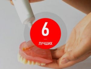 Какой крем для фиксации зубных протезов лучше выбрать