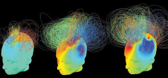 Биоэлектрическая активность мозга