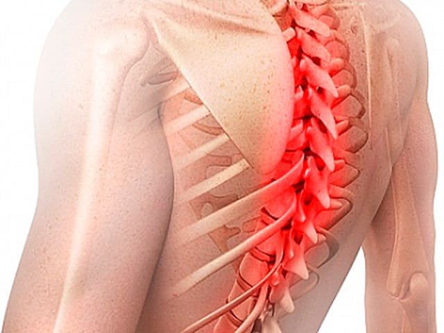Грыжа позвоночника грудного отдела: лечение традиционными и народными методами