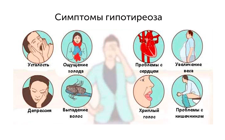 Симптомы гипотиреоза