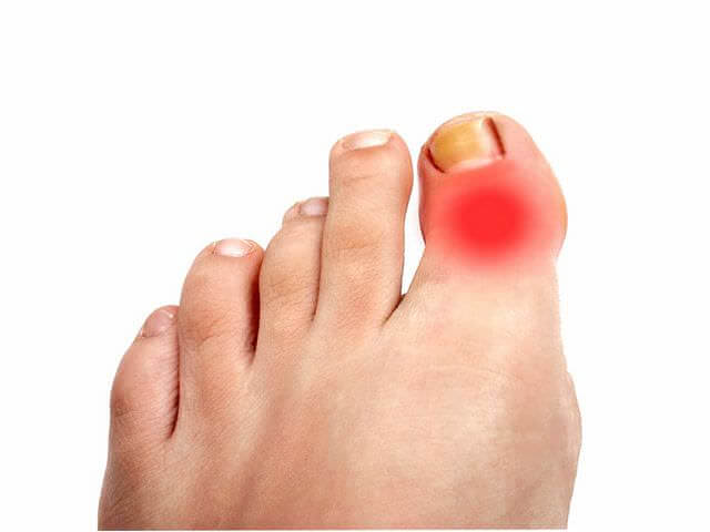 Больной палец на ноге